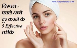 Pimple/ Dark spot kaise door kare 5 Best Tips Hindi