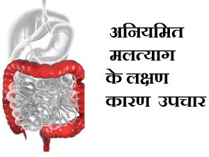 अनियमित मलत्याग के लक्षण, कारण व उपचार ,IBS Irritable Bowel Syndrome Problem In Hindi, Nayichetana.com, ibs problem in hindi