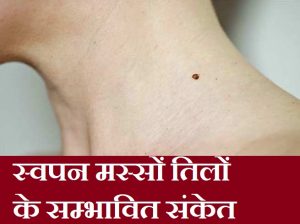 स्वपन मस्सों तिलों के संकेत, Sapno Til Masse Ka Matlab Aur Sanket,sapno ka matlb, masse ka matlb,til ka matlb,dreams mole warts mean in hindi