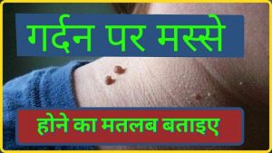 गर्दन पर मस्से होने का मतलब क्या होता है,Neck Par Messe Ka Matlab Bataye, gardan par masse ka matlab,Home Remedies For Warts, maase kya hai