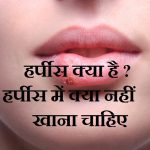 हर्पीस क्या है ? हर्पीस में क्या नहीं खाना चाहिए,Harpes me kya nahi khana chahiye,Harpes me kya khana chahiye,Harpes kya hai,Harpes in hindi