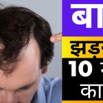 सिर के बाल झड़ने के 10 कारण,10 Reason Losing hair In Hindi,hair loss ke 10 kaaran,hair fall hone ke karan,sir ke bal jhadne ke karan